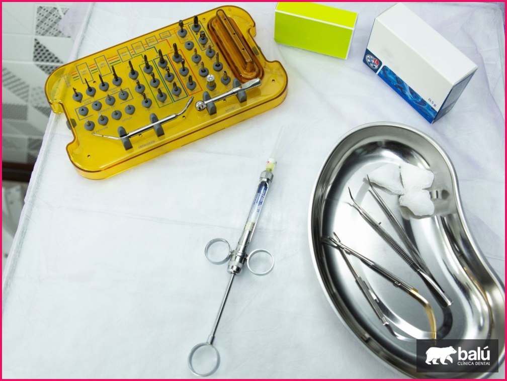 Precio de los implantes dentales: qué factores lo determinan