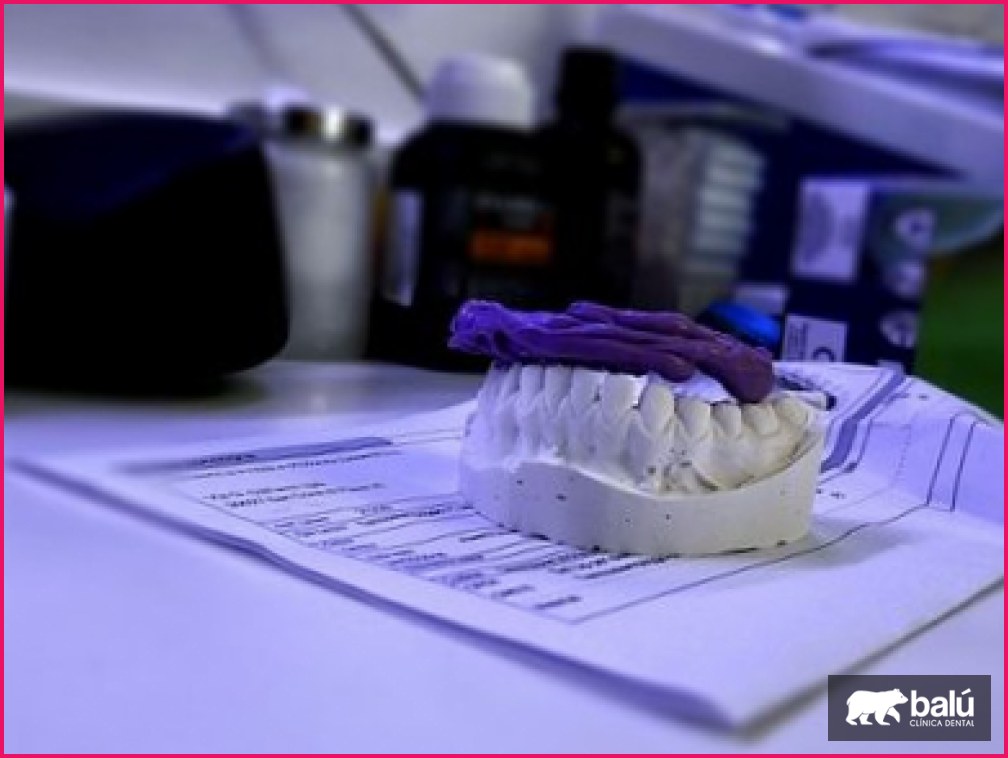 Qué es una prótesis dental fija y qué tipos existen