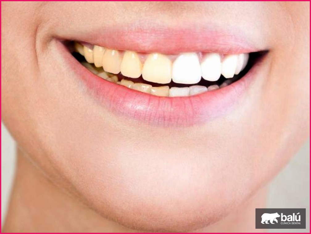 ¿El vino mancha los dientes? Consejos para evitarlo