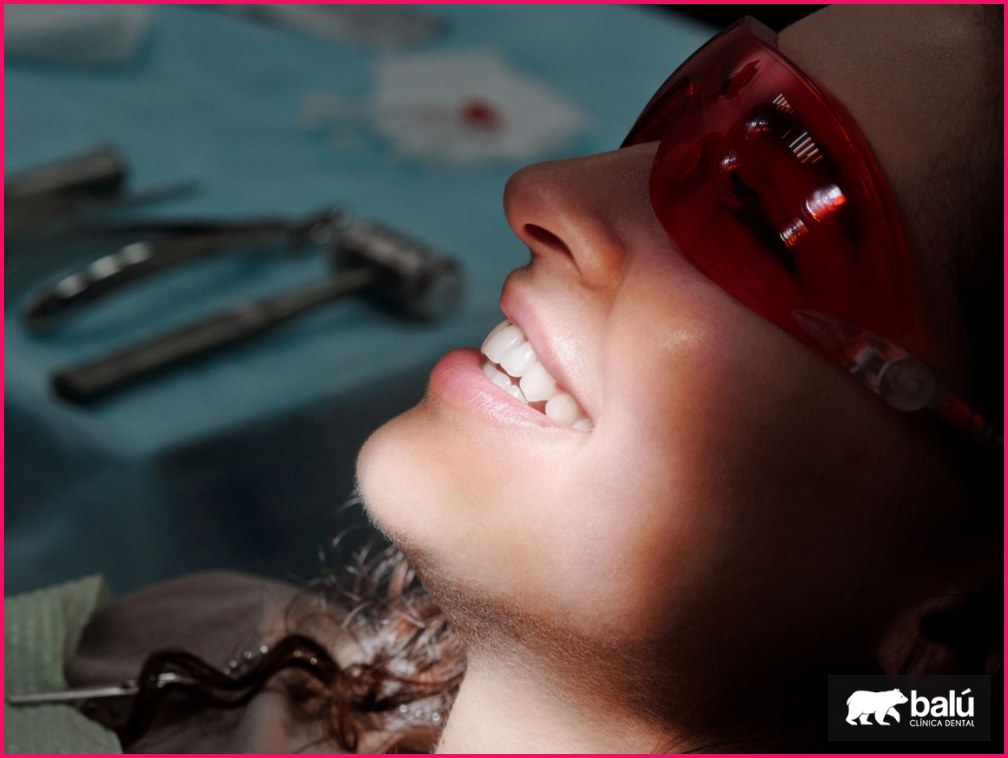 Innovaciones en Estética Dental: Blanqueamiento Dental con Hidroxiapatita